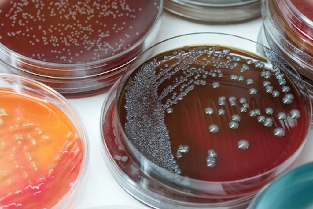 Ensuring Effective Microbial Growth: Proper Storage of Culture Media in West Africa’s Climate.